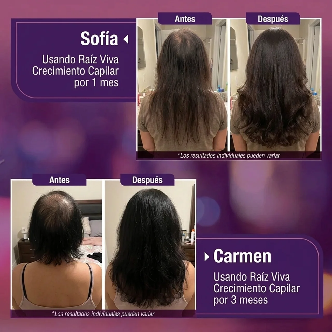 Raíz Viva | Suplemento Crecimiento Capilar Avanzado